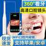 協(xié)愈可視口腔鏡牙醫口腔內窺鏡看牙齒的鏡子高清攝像檢查牙齒無(wú)線(xiàn)wifi 可視口腔鏡-支持WIFI設備-蘋(píng)果白YF-01 曬單實(shí)拍圖