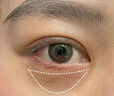 焦博士日本眼霜去眼袋消除重度眼袋專用黑眼圈重度去除女男士中老年神器 曬單實(shí)拍圖