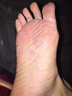 CNDK外用腳臭腳汽腳輕松噴霧劑足部腳癢水泡脫皮糜爛腳汗男女通用溫和 今日活動【強效款-2盒療城裝】 曬單實拍圖