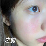曼逖玻尿酸補(bǔ)水噴霧爽膚水小分子保濕濕敷水護(hù)膚品精華女敏感肌300ml 曬單實(shí)拍圖