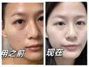 儒意（RUYI）VC爽膚水500ml濕敷水補水保濕水抗皺緊致護膚化妝去黃提亮精華水 曬單實拍圖