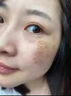 膚研祛斑霜去斑黃褐斑雀斑曬斑女士用的美白醫用祛斑霜老年斑強效淡化 2025新科技 男女醫用【1支裝】 20g 曬單實(shí)拍圖