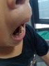 奧樂(lè )V6-12歲潔白系列小孩學(xué)生兒童護牙劑 換牙期蟲(chóng)牙牙黃黑斑 兒童牙膏 【專(zhuān)業(yè)潔白】50克1支裝，送4件禮 曬單實(shí)拍圖