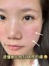 焦博士日本曬后修復(fù)面膜修復(fù)敏感皮膚屏障受損泛紅醫(yī)美用防曬傷急救白 曬單實(shí)拍圖
