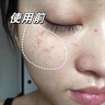 透真377美白祛斑淡化黑色素雀斑抗皺緊致淡紋面部玫瑰精華油去黃次拋 曬單實(shí)拍圖