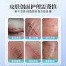華美科醫(yī)用重組人體表皮生長(zhǎng)因子點(diǎn)痣疤痕修復(fù)凝膠燙軟膏傷口愈合15g1支 曬單實(shí)拍圖