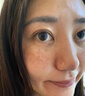 焦博士日本熊果苷乳膏煙酰胺凝膠377美白祛斑霜祛斑美白淡化黑色素面霜 曬單實拍圖