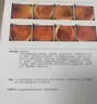 腸炎特療效藥腸胃功能紊亂特新效藥腸胃炎腹痛片慢性腸炎結腸炎腸道感染消炎藥腸胃消化用藥鹽酸小檗堿片 1盒【治多種腸炎】早用早好 曬單實(shí)拍圖