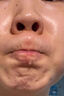 DR.SCT日本鼻炎噴劑專用噴霧神器過(guò)敏性鼻炎油鼻竇可搭膏藥貼 曬單實(shí)拍圖