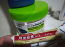 DAGO雞皮膚疙瘩毛囊角化癥專用的藥去角質(zhì)疙瘩大腿手臂去除神器特傚膏 曬單實(shí)拍圖