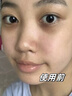 Losoki瑞士進(jìn)口眼膜京東自營(yíng)淡紋眼膜貼眼袋提拉緊致抗皺淡化黑眼圈 曬單實(shí)拍圖