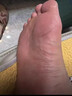 CNDK足部真菌王腳氣腳癢水泡脫皮腳臭香港腳腳汗爛腳丫真菌感染止癢膏 濃度999+【強效款嚴重腳氣】 曬單實(shí)拍圖