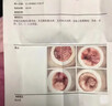 SWLRDRS德國痔瘡膏痔瘡專用非藥肉球去內(nèi)外混合痔瘡凝膠栓去斷肉球神器根 三盒【肉球脫出便血100%特效】 曬單實(shí)拍圖