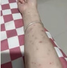 體股癬牛皮膚癬專(zhuān)用特正效藥銀屑病藥膏真菌王止癢抑菌皮膚皮炎濕疹皮癬真菌感染止癢膏身體癢硝酸咪康唑乳膏 1盒硝酸【皮炎濕疹皮癬真菌感染】醫用級 曬單實(shí)拍圖