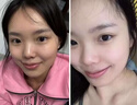 OHBT黃芪面膜10片抗皺緊致抗衰老補水熬夜美白淡斑女男士金榜第1名 曬單實(shí)拍圖
