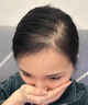 維特絲（vetes）育發(fā)液防脫發(fā)育發(fā)濃密增長液生發(fā)劑固發(fā)增長密男女頭皮護(hù)理精華液 曬單實拍圖