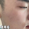Newliann醫用械字號洗面奶狀潔面乳控油祛痘除螨蟲(chóng)去黑頭男士女士修復屏障 曬單實(shí)拍圖