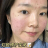 BEAI B5積雪草面膜補水保濕曬后修復(fù)敏感去黃提亮抗皺熬夜急救男女士 曬單實拍圖