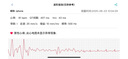 KPEP【醫(yī)療認(rèn)證】血壓血糖血脂尿酸ECG心電心率血氧睡眠遠(yuǎn)程關(guān)愛離線支付NFC藍(lán)牙通話智能健康手表 【醫(yī)療認(rèn)證】GJ-SH-03黑色 曬單實(shí)拍圖