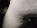 北京協(xié)和醫學(xué)院止癢膏止癢抑菌皮膚瘙癢身體癢止癢特效皮濕炎疹真菌感染過(guò)敏藥膏 1盒【止癢特效噴霧劑】中日共研 皮膚癢越抓越癢皮膚藥膏止癢效果最好多買(mǎi)的藥 曬單實(shí)拍圖