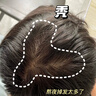 BEAI防脫育發(fā)液固發(fā)營(yíng)養增長(cháng)液發(fā)際線(xiàn)生長(cháng)液長(cháng)發(fā)劑非米諾地爾酊30ml 曬單實(shí)拍圖