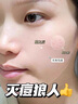 SEEDONVEUR醫研痘痘貼吸膿消炎隱形遮瑕抗痘祛痘化妝水膠體貼圓形透明108貼 曬單實(shí)拍圖