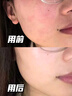 OHBT黃芪爽膚水300ml補(bǔ)水保濕抗皺緊致精華水提亮化妝濕敷水護(hù)膚品 曬單實(shí)拍圖