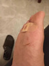 同仁堂雞眼貼（內含棉簽）去雞眼膏手部腳后根肉刺無(wú)刺痛脫落 6貼/盒 曬單實(shí)拍圖