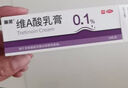 麗芙維a酸乳膏0.025%10g去祛痘藥膏醫(yī)用淡化痘印黑頭去雞皮膚黑色素可搭異維A酸尿素軟膏乳膏凝膠囊 曬單實拍圖