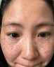 焦博士日本377祛斑霜美白淡化老年黃褐雀斑黑色素熊果苷乳膏去曬男女士 曬單實拍圖