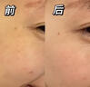 儒意（RUYI）淡紋眼霜30g淡化細(xì)紋眼紋抗皺提拉緊致黑眼圈抗祛眼袋衰老護(hù)膚品 曬單實(shí)拍圖