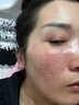 Aromat Herbs澳洲進(jìn)口美白祛斑乳液377煙酰胺去黃提亮滋潤補水保濕護膚品套裝 【美白淡斑】乳液+水+面霜+精華 曬單實(shí)拍圖
