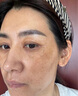 維特絲377面霜乳液美白淡斑保濕補水男女水乳抗皺緊致淡化黑色素護膚品 曬單實(shí)拍圖