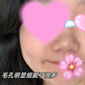 白云山壬二酸水楊酸清潔泥膜深層清潔去黑頭收縮毛孔撕拉面膜鼻膜棒150g 曬單實(shí)拍圖