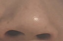 吸黑頭儀吸黑頭清理神器黑頭吸出器面部小氣泡清潔儀粉刺毛孔深層去黑頭男女士美容儀禮物送女友 【全配充電款】吸力強勁+深層清潔+秒去黑頭 曬單實(shí)拍圖