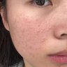 儒意去角質(zhì)面部啫喱控油保濕洗面奶男女士臉部清潔毛孔黑頭閉口敏感肌 【一次見效】去角質(zhì)啫喱 300g 曬單實(shí)拍圖