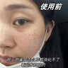 奈皙日本377煙酰胺美白祛斑霜淡化黑色素去雀斑老年黃褐斑面霜男女士 曬單實拍圖