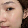 維特絲壬二酸祛痘藥膏煙酰胺凝膠去痘痘粉刺閉口男女水楊酸收毛孔青少年 曬單實(shí)拍圖