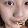 儒意（RUYI）去黑頭鼻貼免撕拉面膜黑頭導出液清理神器收縮毛孔清潔粉刺男女士 曬單實拍圖