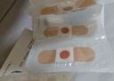 葵花雞眼貼膏扁平疣跖疣去腳根肉刺無(wú)痛脫落專(zhuān)用足部手部腳底老繭瘊子 曬單實(shí)拍圖