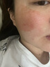 普門科技醫(yī)用大排燈美容儀紅藍(lán)黃光治療敏感肌痘痘痤瘡消炎七夕禮物送女友 光E【三光+12模式】 曬單實(shí)拍圖
