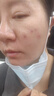 可復美面膜組合 重組膠原蛋白保濕修護面膜 痘痘肌膚敏感皮舒緩泛紅屏障 修復貼2片 曬單實(shí)拍圖