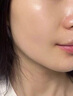 維特絲壬二酸祛痘藥膏煙酰胺凝膠去痘痘粉刺閉口男女水楊酸收毛孔青少年 曬單實(shí)拍圖