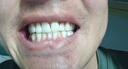 INSTANT SMILEinsmile美白牙膜因適美牙齒美白凝膠亮白去黃神器無(wú)刺激去牙漬 美白牙膜 單支（30毫升） 曬單實(shí)拍圖