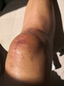 李寧護膝運動(dòng)半月板髕骨醫專(zhuān)用夏季跑步籃球男女羽毛球登山膝蓋護具 曬單實(shí)拍圖