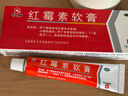 仁和 紅霉素軟膏1%*15g/支 抗菌消炎止癢 膿皰瘡化膿性皮膚病燒傷潰瘍面的感染 痤瘡 曬單實(shí)拍圖