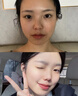 澳芙雪377補(bǔ)水面膜美白補(bǔ)水淡斑提亮膚色女男士清潔祛斑抗皺緊致抗衰老 1盒 【體驗(yàn)裝】實(shí)發(fā)5片 曬單實(shí)拍圖