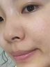 阿達(dá)帕林凝膠改善毛孔粗大去看黑頭醫(yī)用 祛痘消炎痤瘡專用青少年 正品臉上長痘痘專用藥京東自官營方旗艦店 3盒療程【堅(jiān)持一個(gè)月 毛孔再見】 曬單實(shí)拍圖