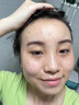 Newliann醫用重組三型人源化膠原蛋白外用人表皮生長(cháng)因子凝膠皮膚疤痕修復 曬單實(shí)拍圖