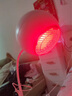 PHILIPS飛利浦紅外線(xiàn)理療燈烤燈理療儀紅光烤電神燈教師節禮物實(shí)用 曬單實(shí)拍圖